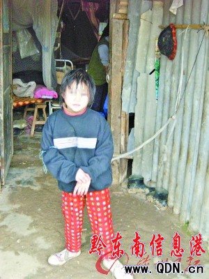 10歲智障女童被父母用繩索拴在家中6年(圖)
