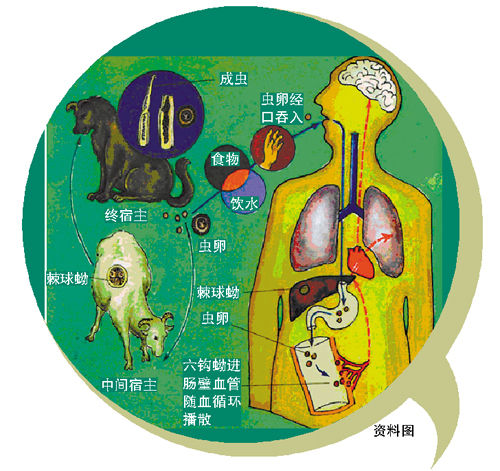 小周術(shù)后恢復良好,目前已能借助康復工具下床行走。