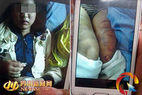 女子疑遭公公虐待下身灌水警方稱部分失實(圖)